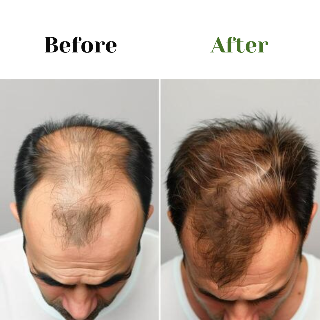 Aala Brand Traditional Adiwasi Herbal Hair Oil – Natural Hair Growth ❤️