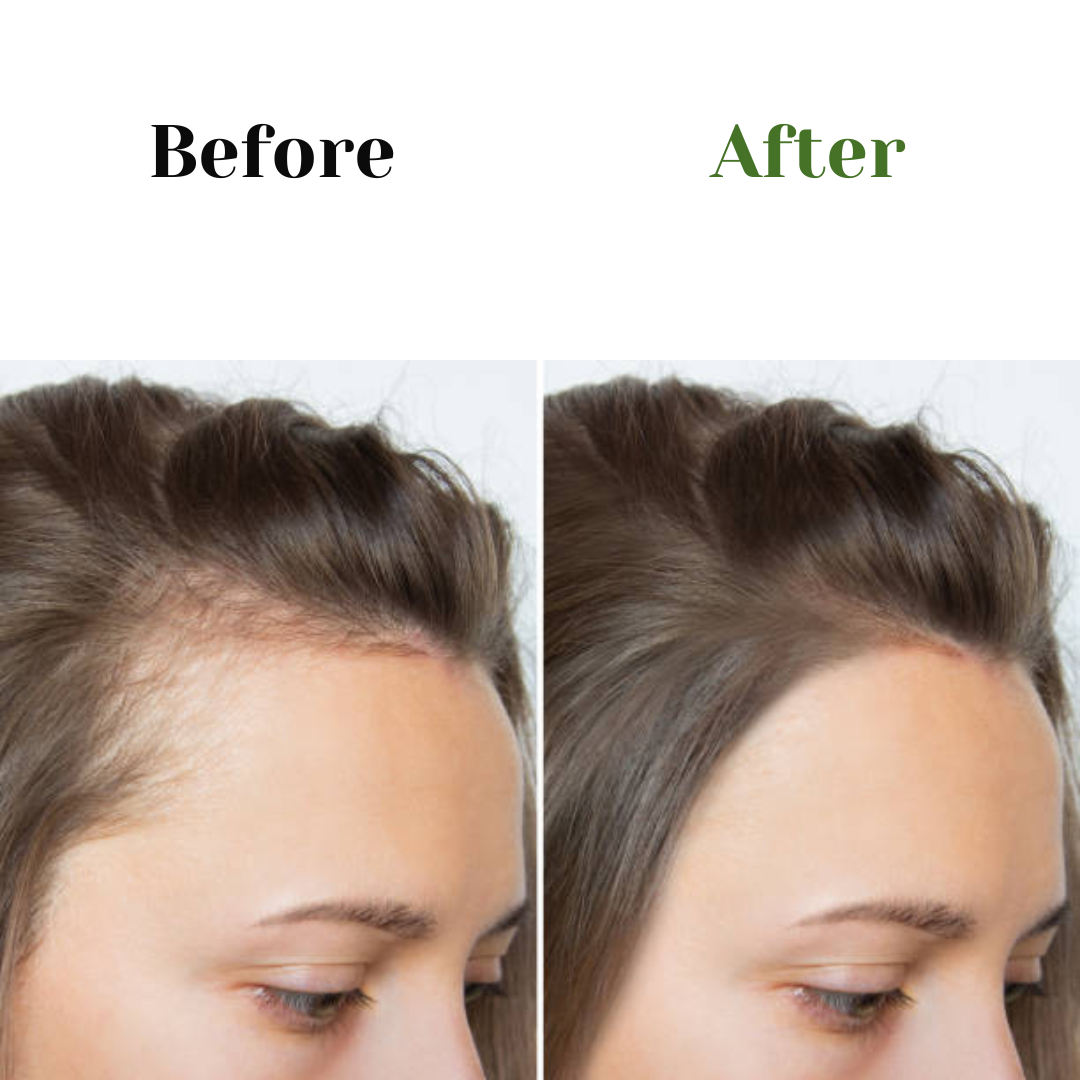Aala Brand Traditional Adiwasi Herbal Hair Oil – Natural Hair Growth ❤️