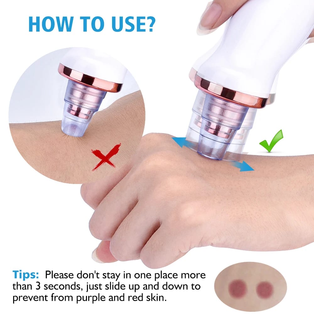 Original 5-in-1 Blackhead remover 🤩 | Multi-Functional | With Rechargeable 🔋